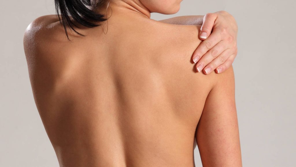 Young woman with frozen shoulder