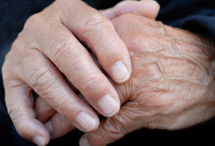 Older Man with Arthritic Hands