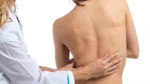 Young woman with scoliosis being treated